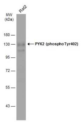 Western Blot: PYK2/FAK2 [p Tyr402] Antibody [NBP3-13314]